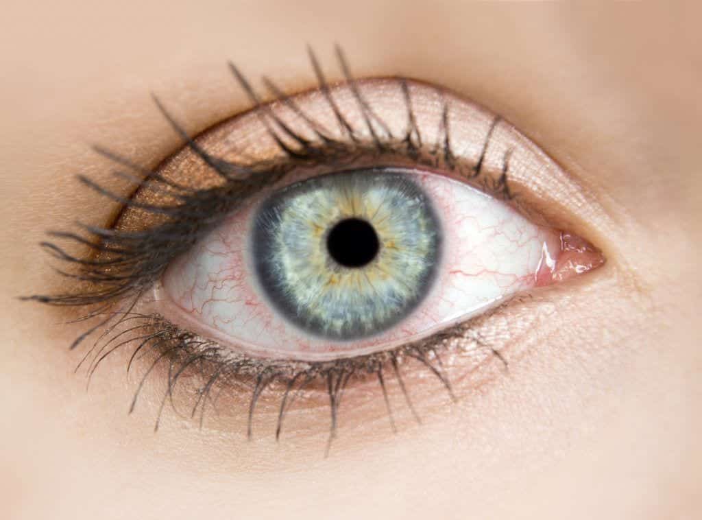 Closeup of woman's blood shot eye